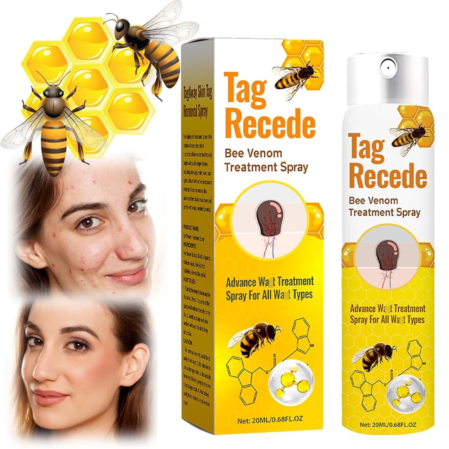 Tag Recede Bee Venom, TagRecede Bee Venom Treatment Spray (1 Piece)