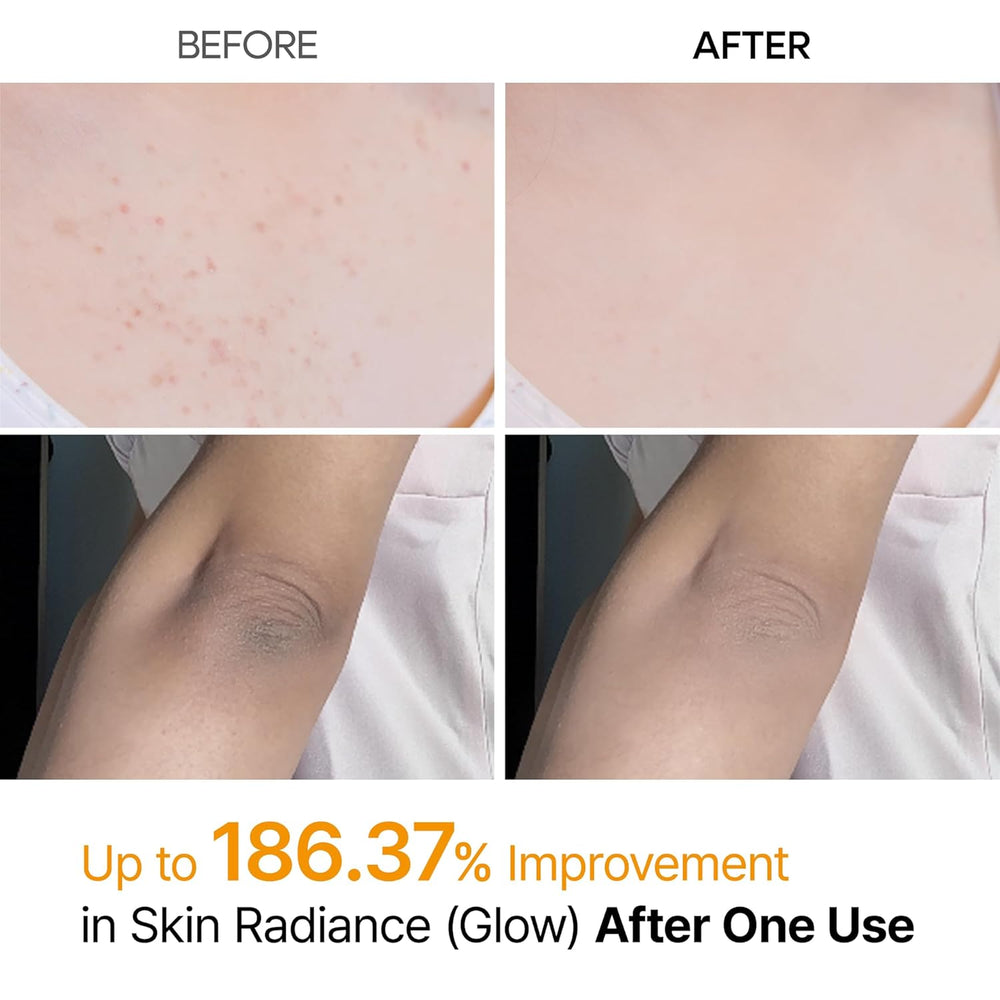 Daily Peeling Spray